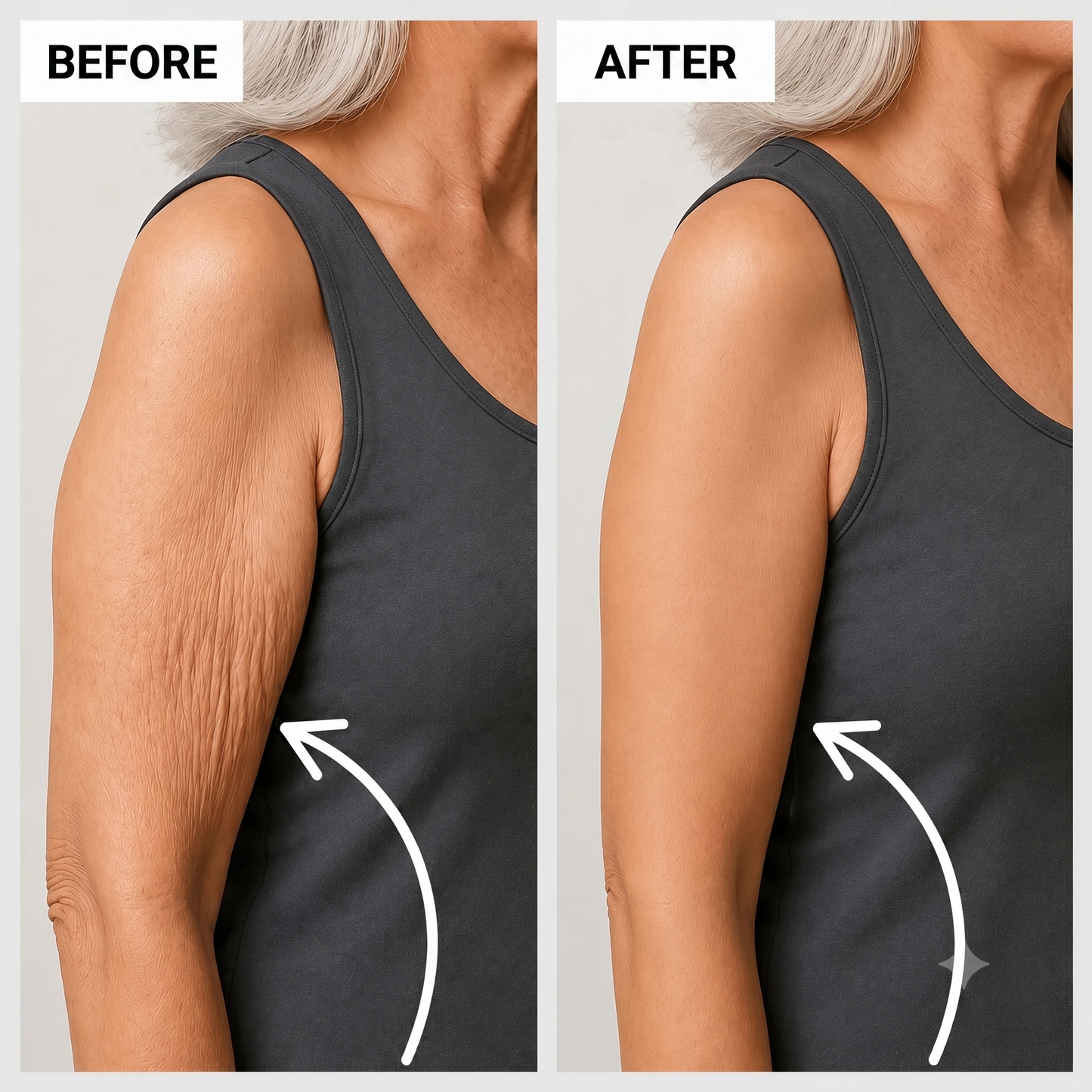Calmira® Firming Arm Sleeves - DermaTherm™